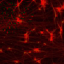 bit.bio Glutamatergic Neurons MAP2 ICC at day 11