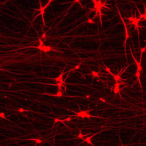 bit.bio ioGlutamatergic Neurons - Day 11 - MAP2 square
