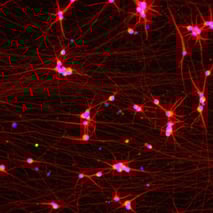 bit.bio Glutamatergic Neurons MAP2, VGLUT2, DAPI ICC at day 11