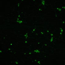bit.bio Glutamatergic Neurons VGLUT2 ICC at day 11