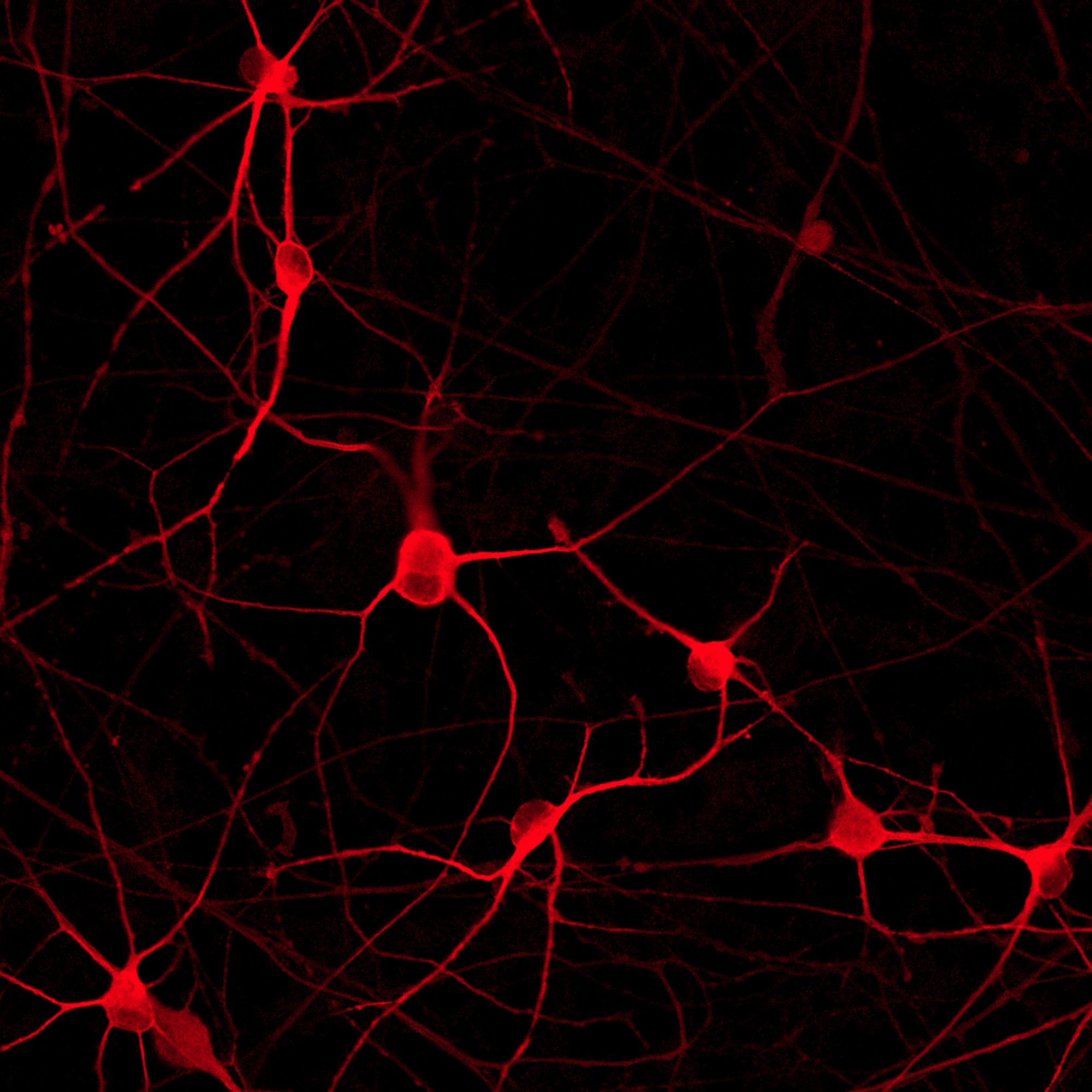 io1013S-ioGlutamatergic-Neurons-PRKN-R275W-heterozygous-ICC-MAP2 compressed