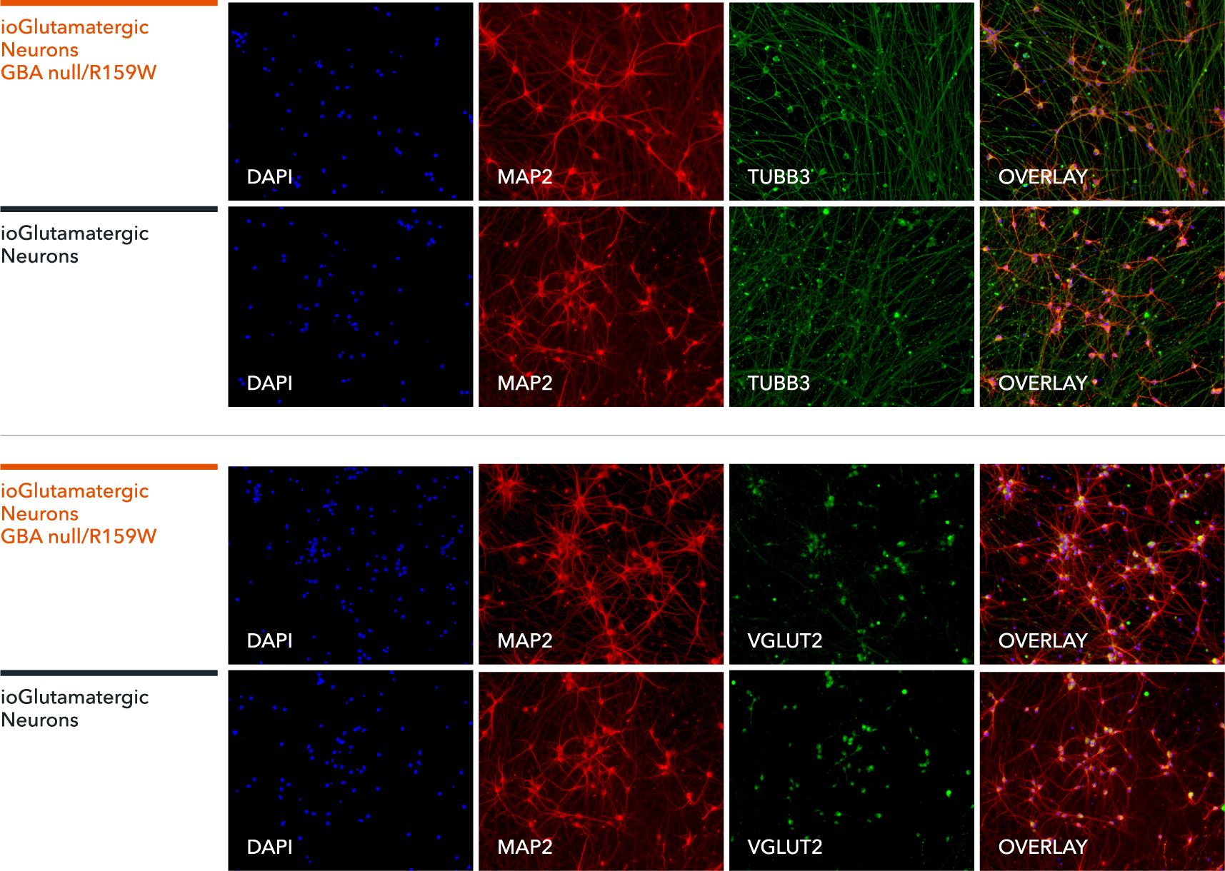 io1007-ioGlutamatergic-Neurons-GBA-null-R159W-ICC-TUBB3-MAP2-VGLUT2