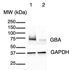 io1007_GBA null-R159W_western-blot