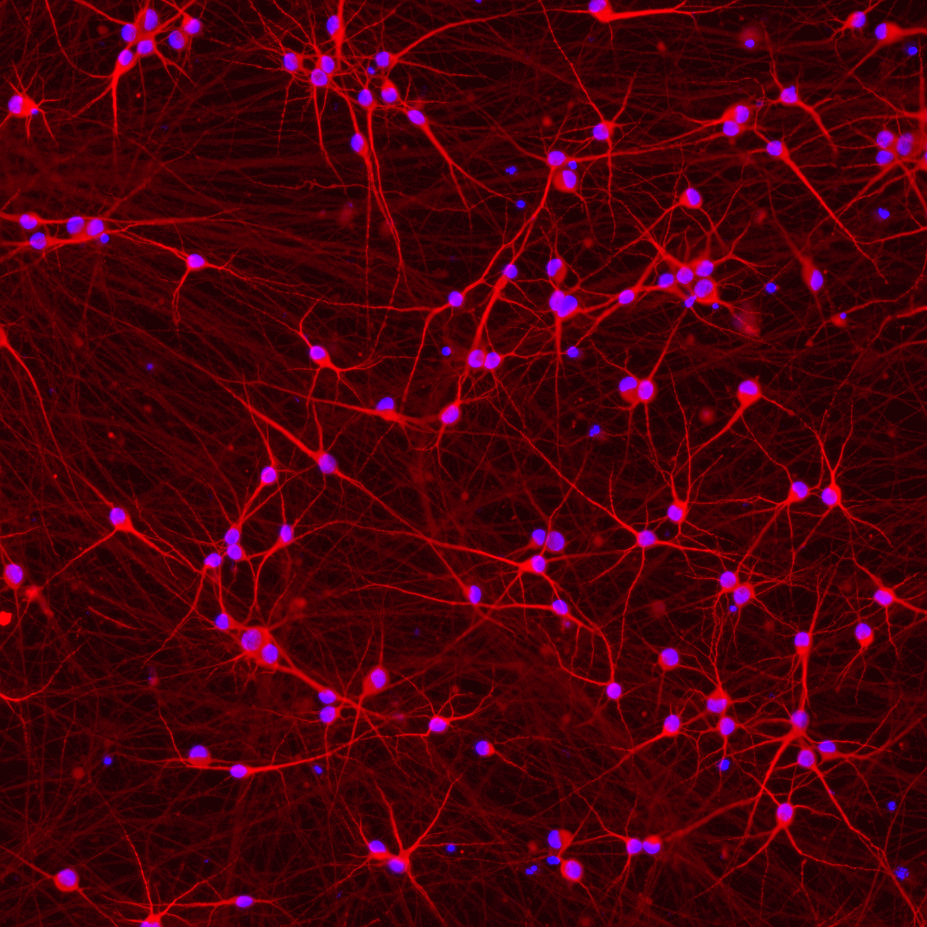 ioGlutamatergic Neurons APP V717I/WT