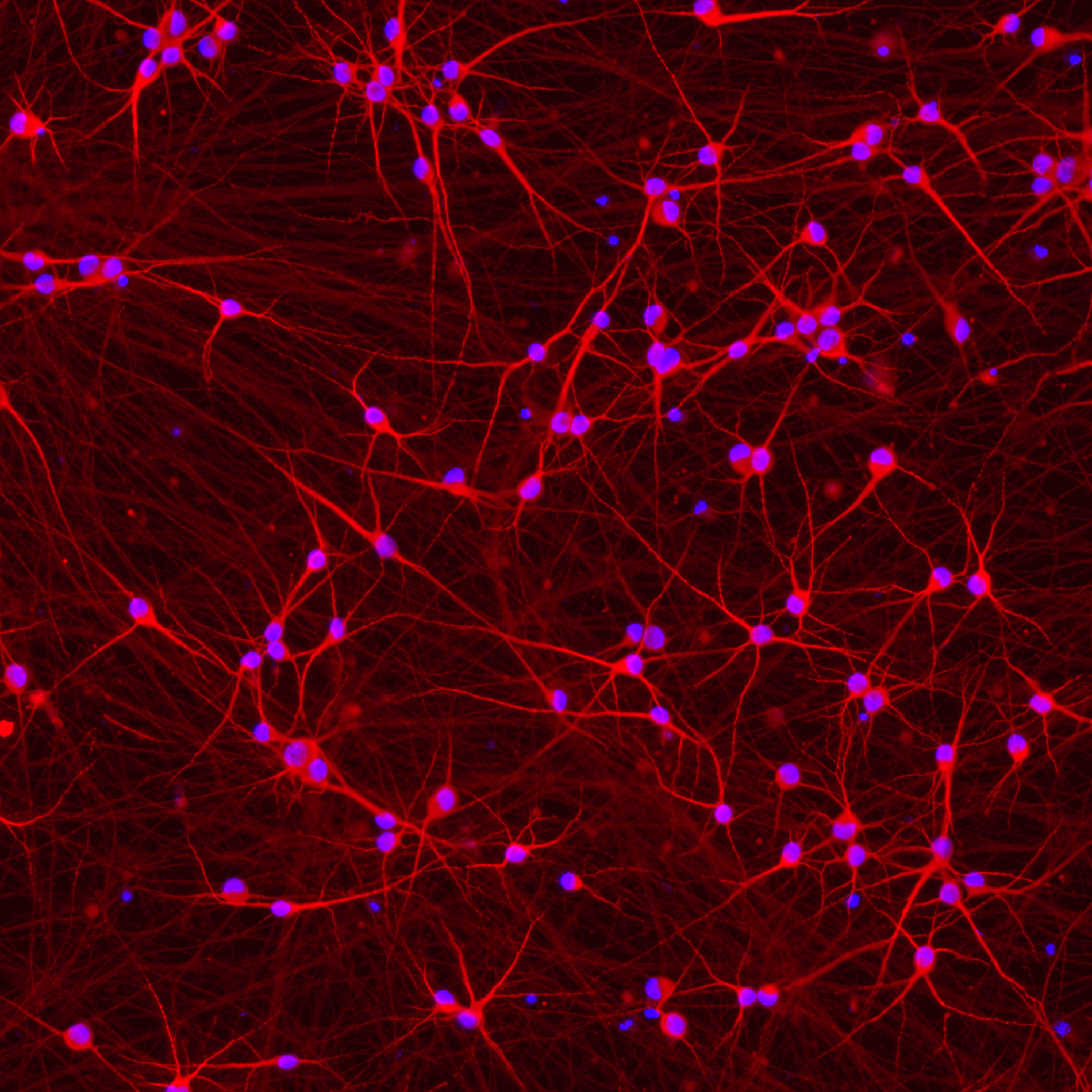 ioGlutamatergic Neurons APP V717I/WT™