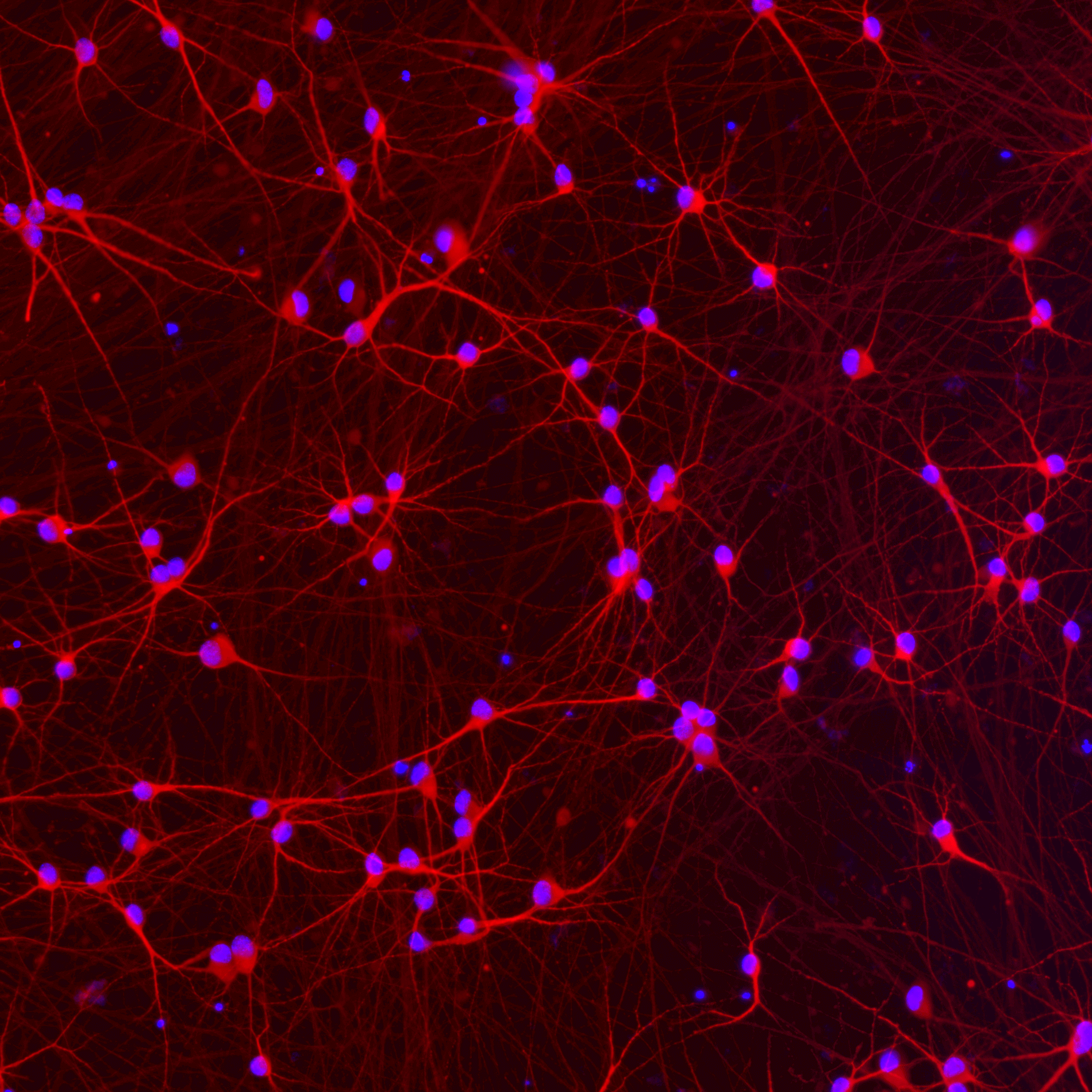 ioGlutamatergic Neurons APP KM670/671NL/WT