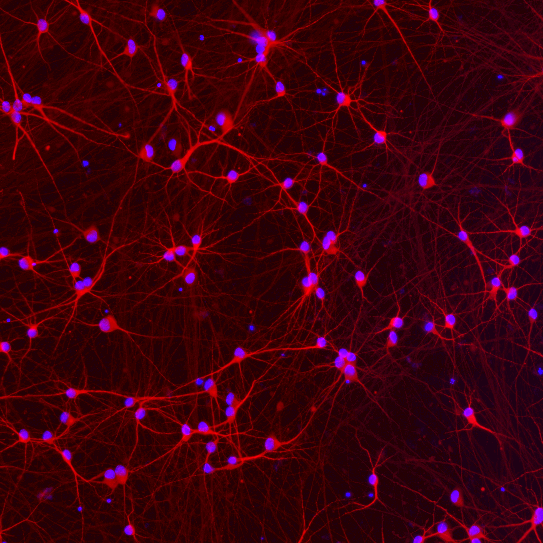 ioGlutamatergic Neurons APP KM670/671NL Hom™