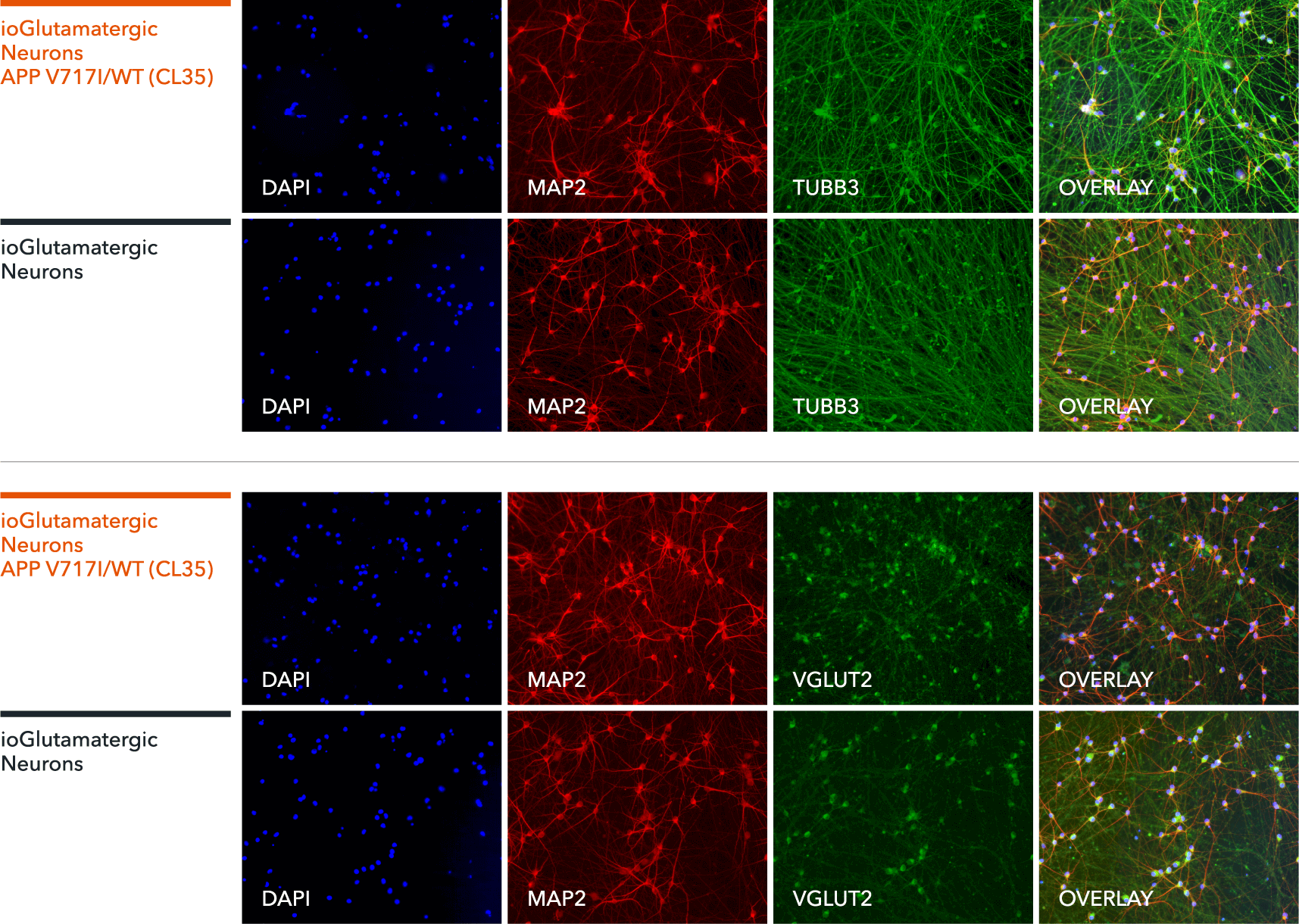 bit.bio Staining of glutamatergic neuron markers beta3 tubulin, MAP2 and VGLUT2 in the APP V717I het disease model