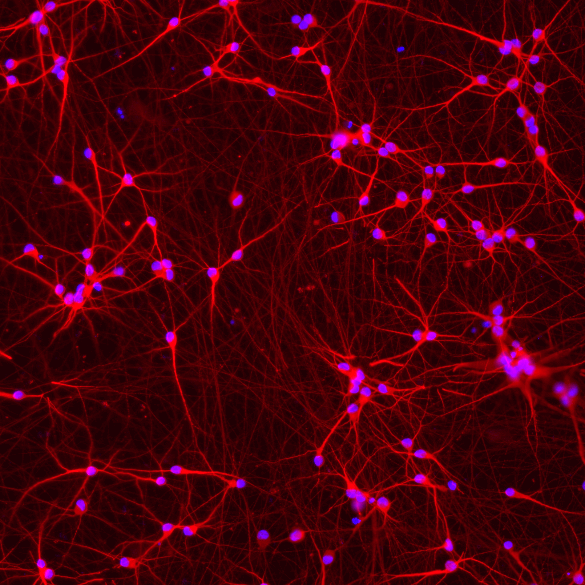 ioGlutamatergic Neurons APP V717I/V717I™
