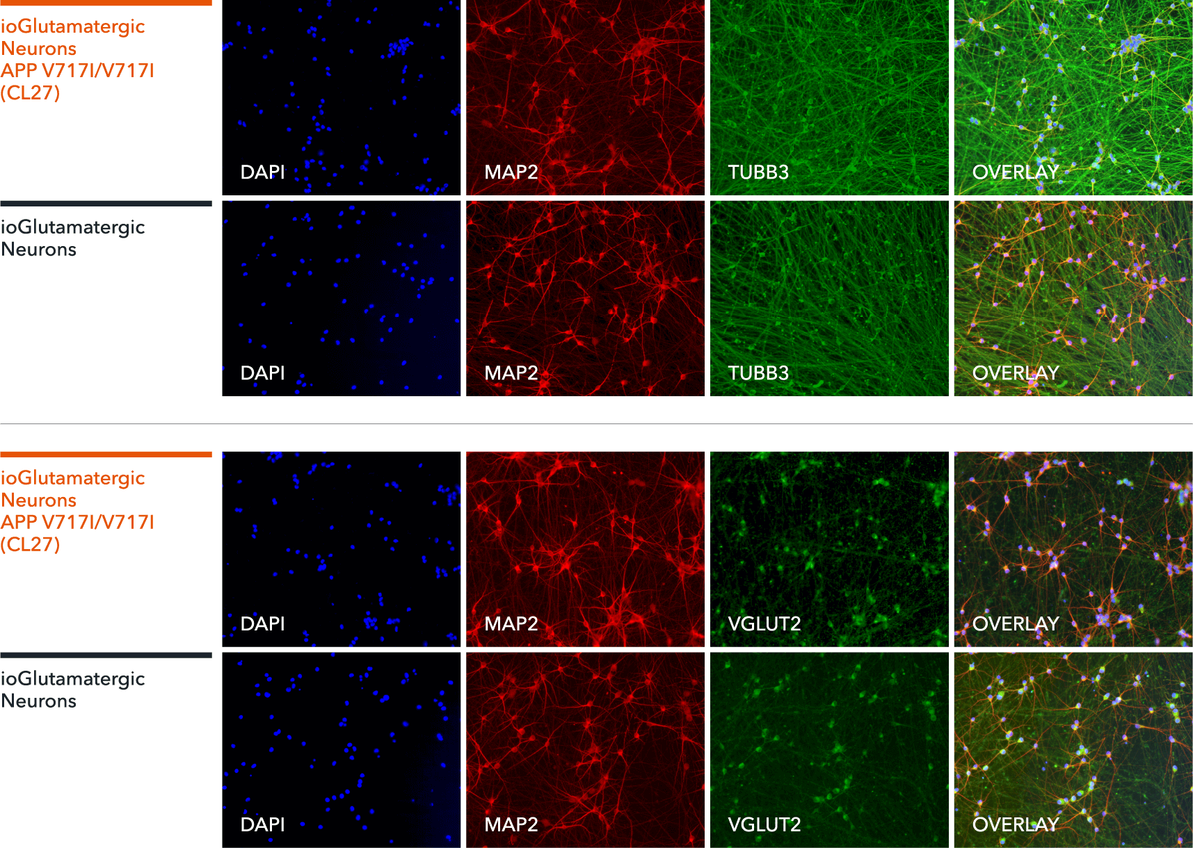 bit.bio Staining of glutamatergic neuron markers beta3 tubulin, MAP2 and VGLUT2 in the APP V717I hom disease model