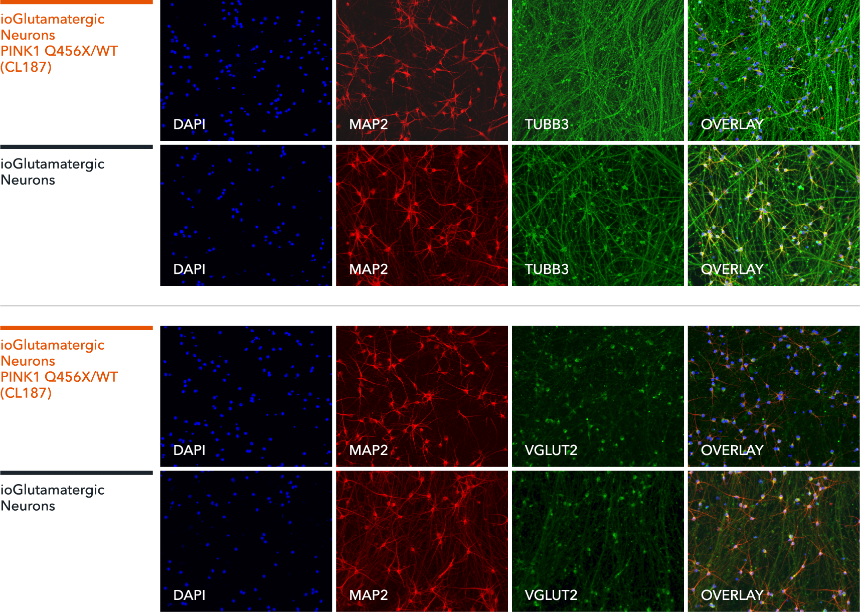 bit.bio Glutamatergic Neurons PINK1 Q456X/WT ICC marker staining TUBB3, MAP2, VGLUT2