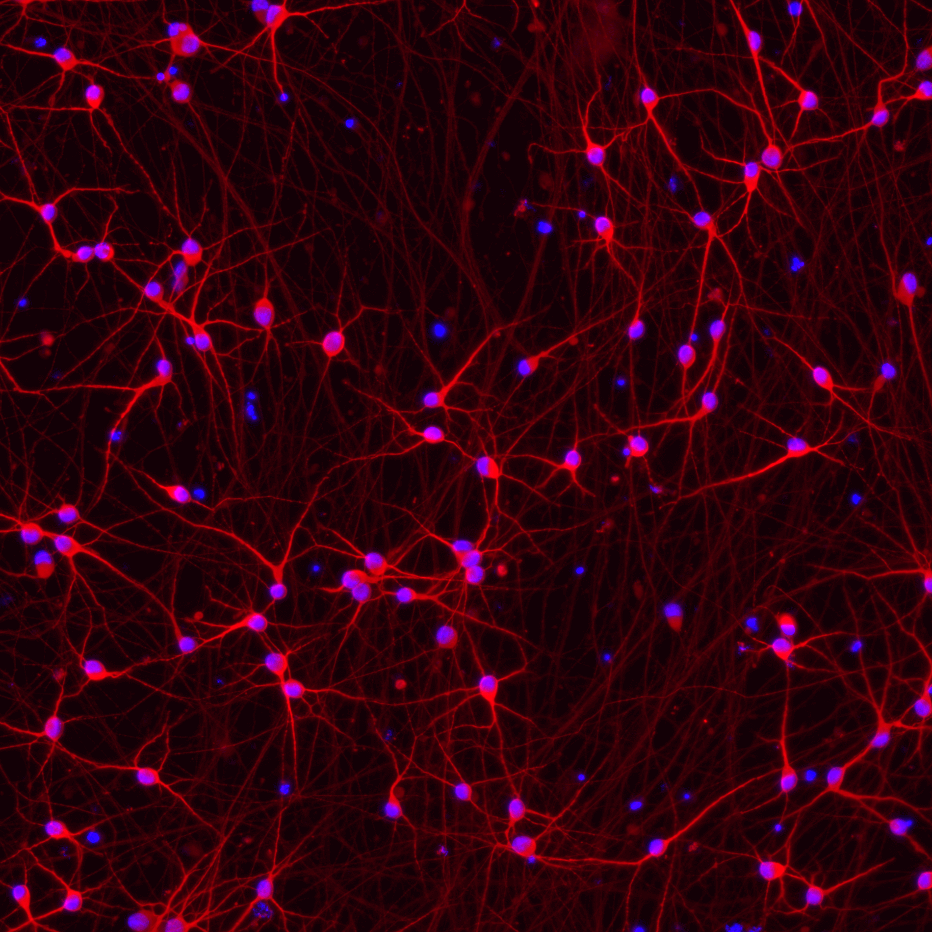 bit.bio Glutamatergic neurons PINK1 Q456X Hom ICC MAP2 staining