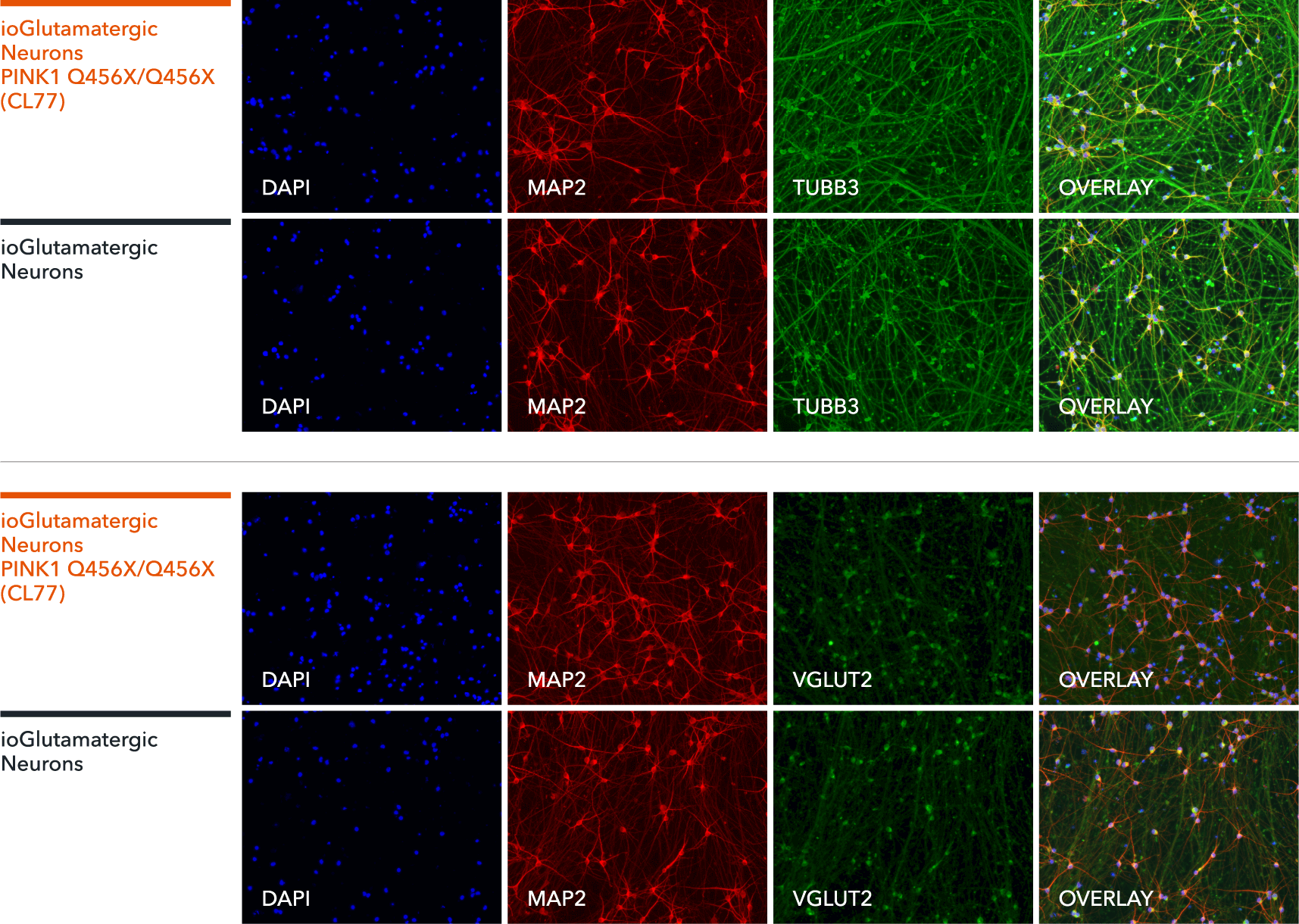 bit.bio Glutamatergic Neurons PINK1 Q456X hom ICC marker staining TUBB3, MAP2, VGLUT2
