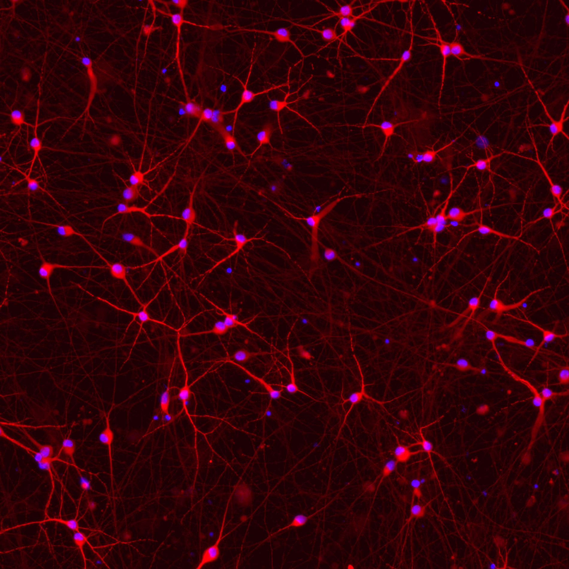 ioGlutamatergic Neurons PSEN1 M146L/WT™
