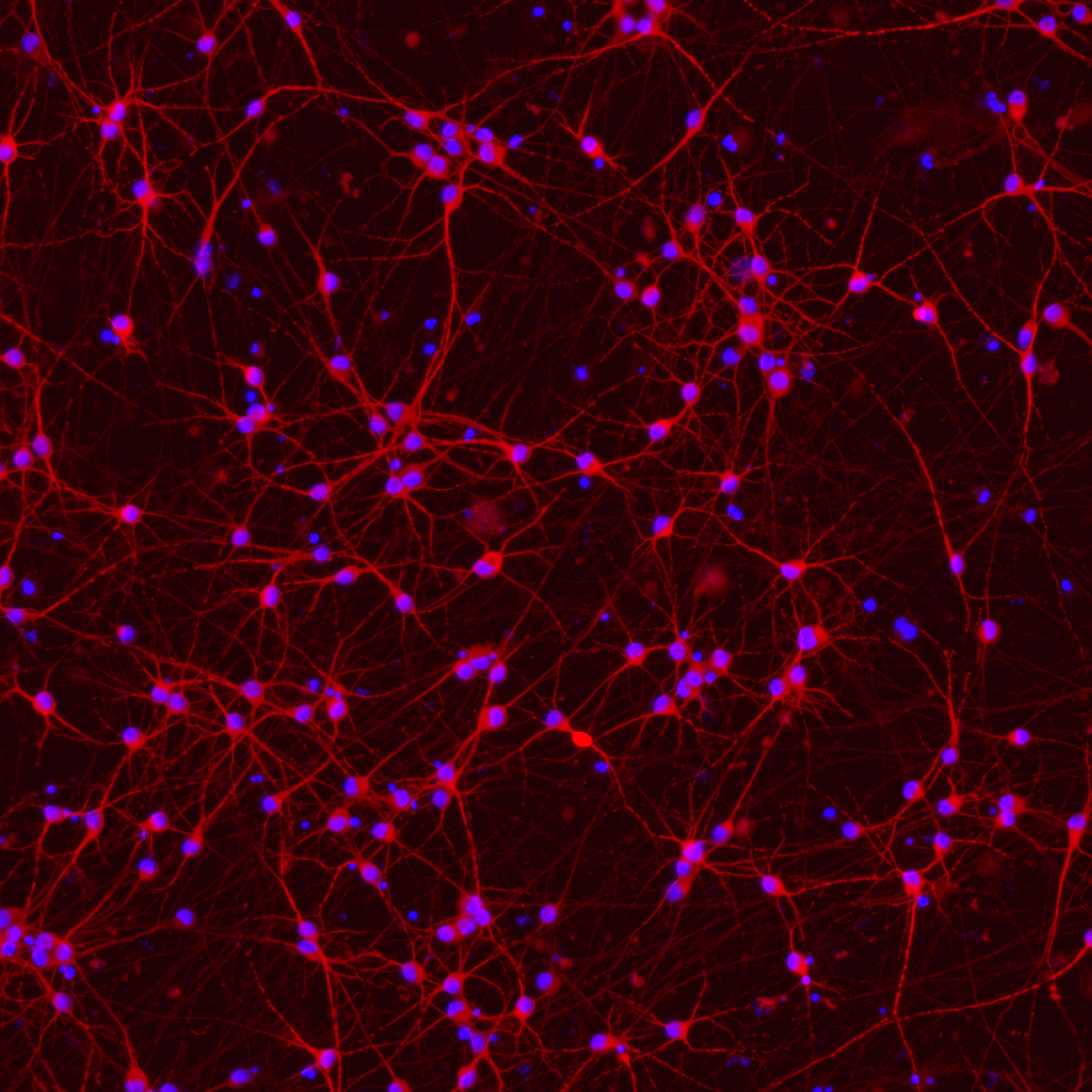 ioGlutamatergic Neurons PSEN1 M146L/M146L™