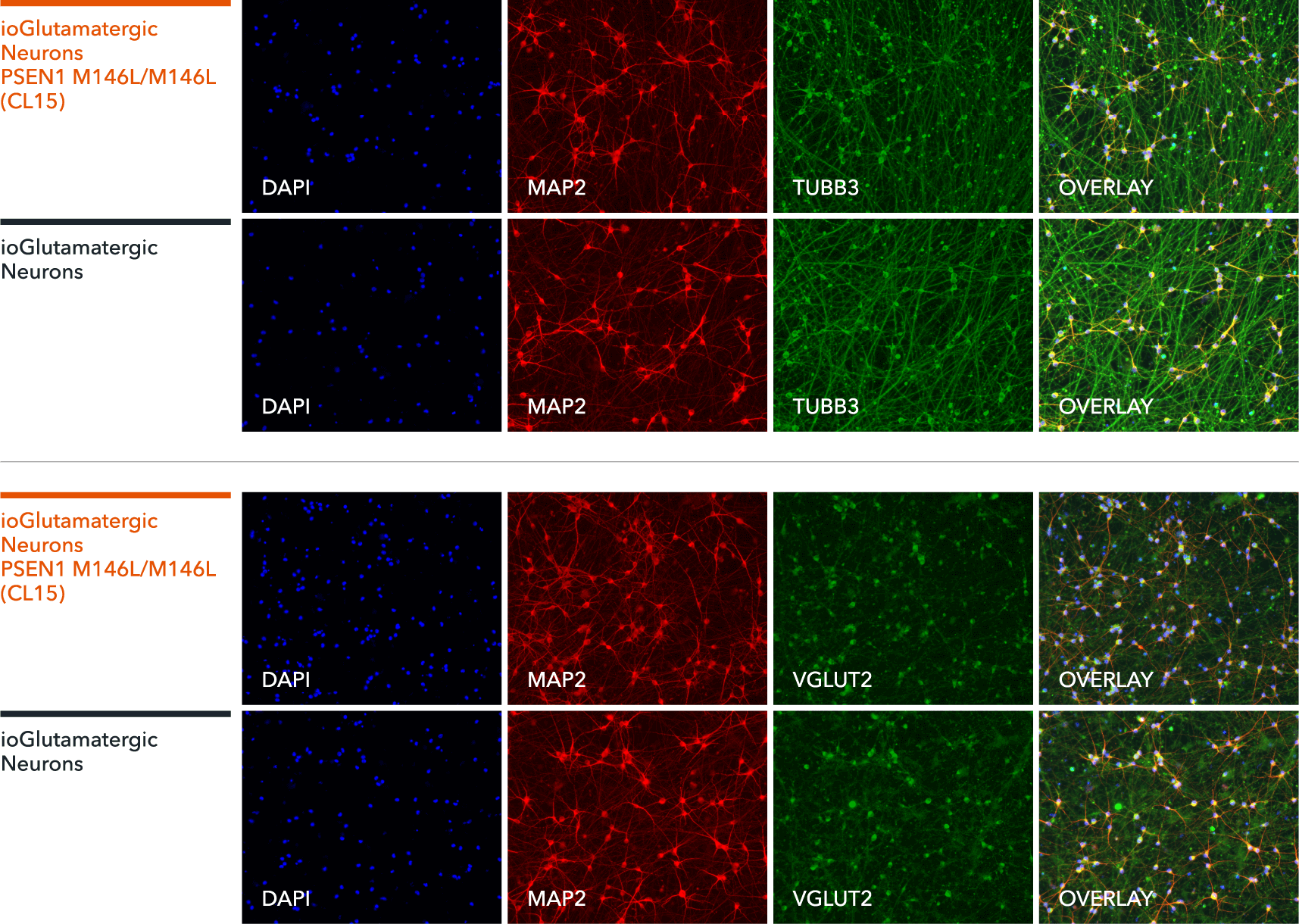 bit.bio Glutamatergic-Neurons PSEN1 M146L hom ICC marker staining TUBB3 MAP2 VGLUT2