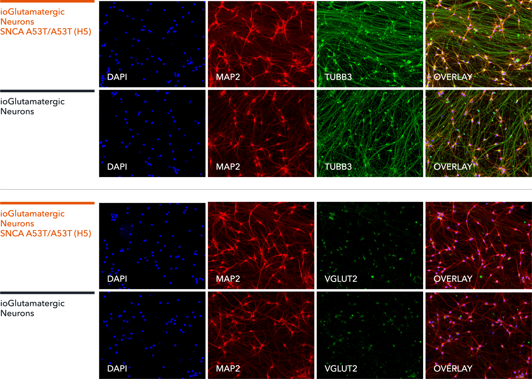 bit.bio Glutamatergic Neurons SNCA A53T hom ICC staining MAP2, TUBB3, VGLUT2