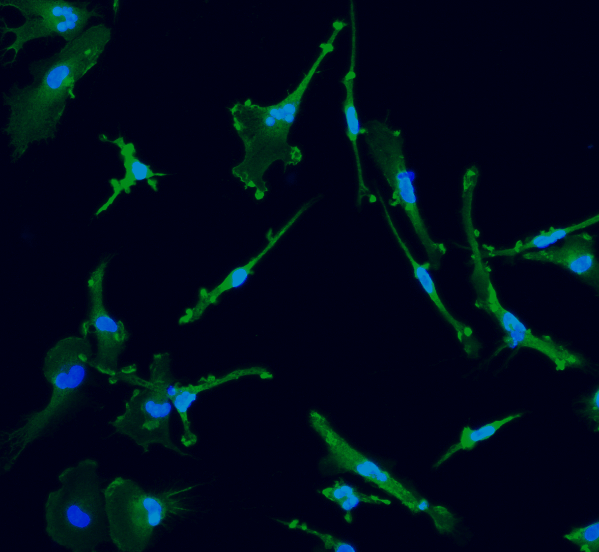 ioMicroglia APOE 4/4 C112R/C112R