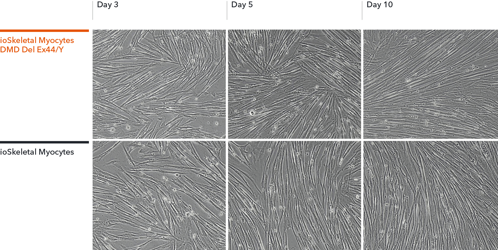  ioSkeletal Myocytes DMD Exon 44 classical myocyte morphology shown at day 10 post revival by bright-field imaging.