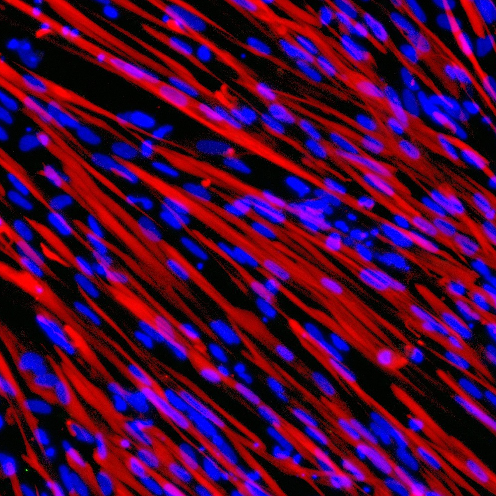 ioSkeletal Myocytes DMD Exon 44 Deletion™