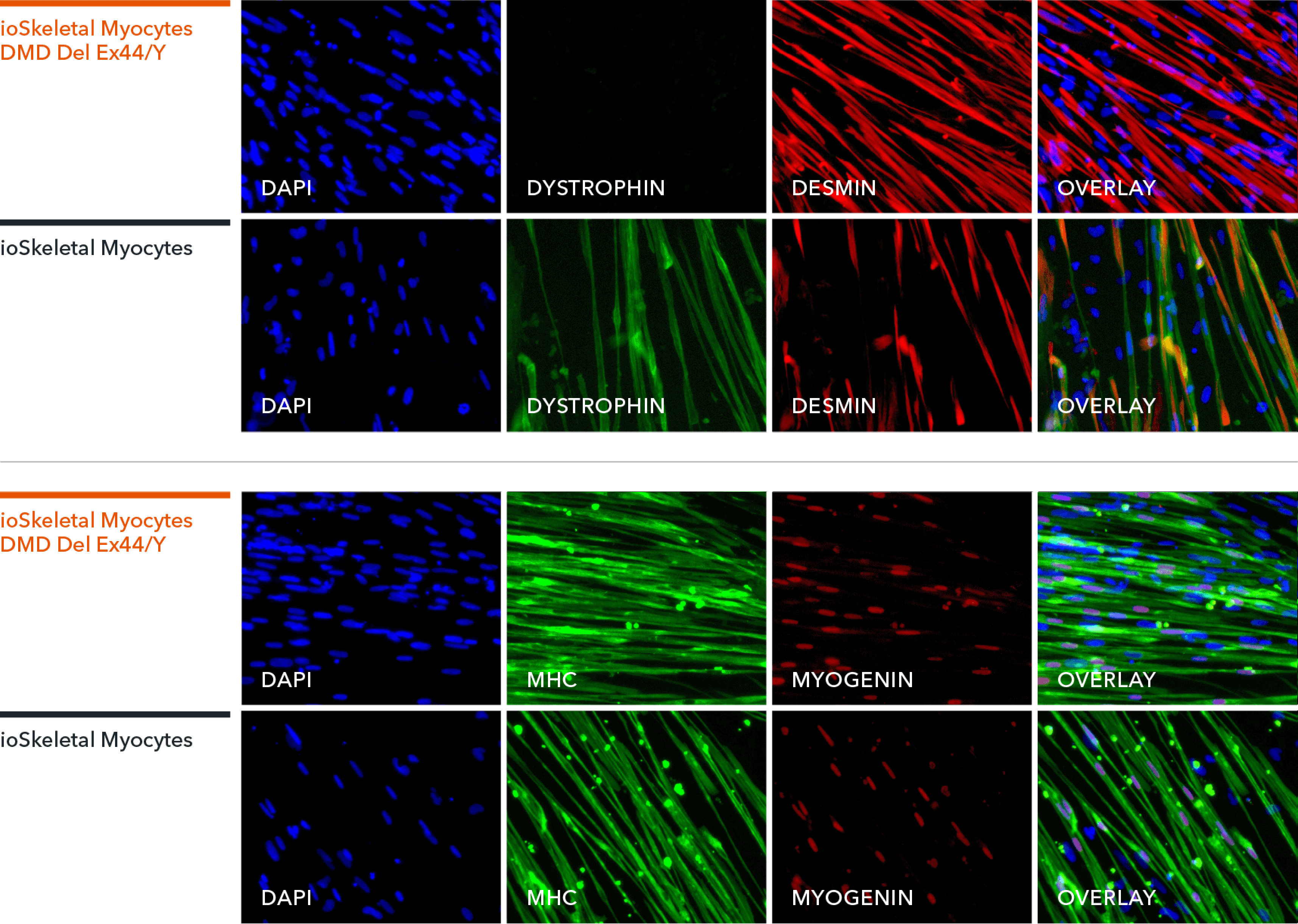 Skeletal Myocytes DMD Exon 44 Deletion | ioCells