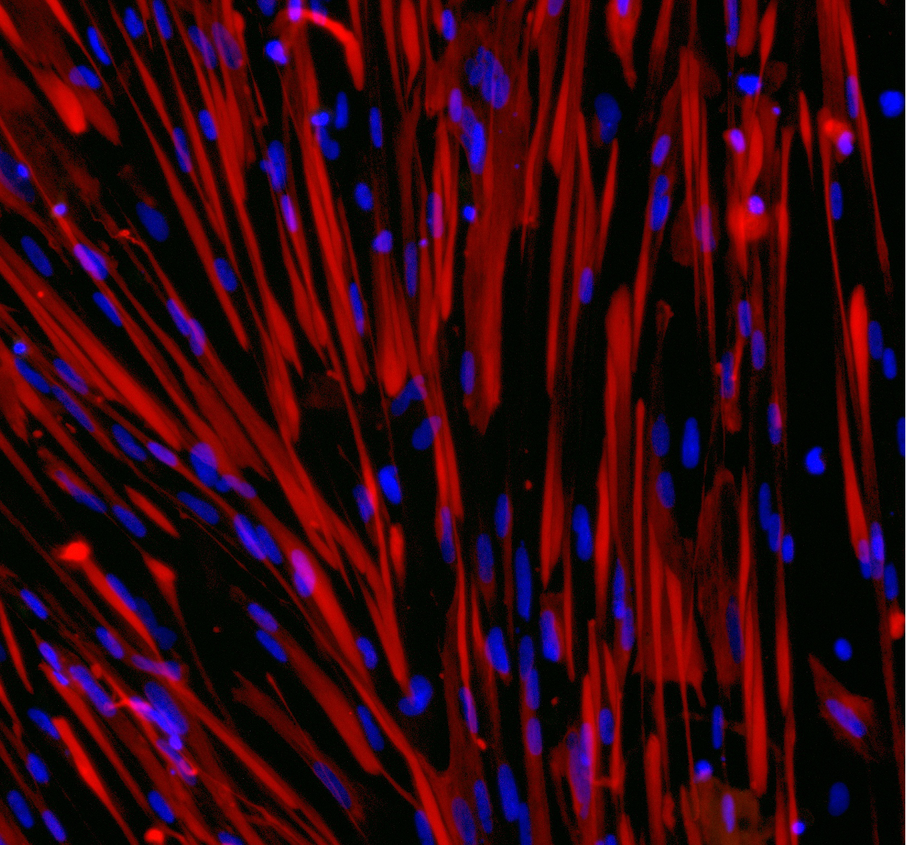 ioSkeletal Myocytes DMD Exon 52 Deletion™