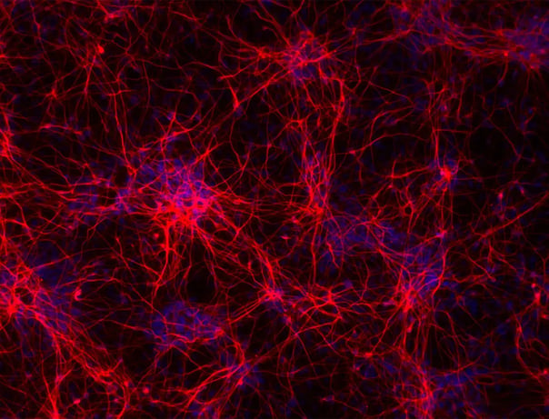 Tau aggregate replication occurs at the pre-synapse of cultured human neurons and increases with application of TNFɑ
