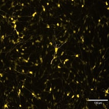 ioGABAergic Neurons ICC GABA