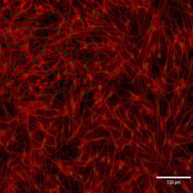 ioGABAergic Neurons ICC MAP2