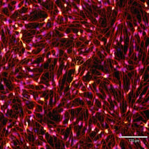 ioGABAergic Neurons ICC merge