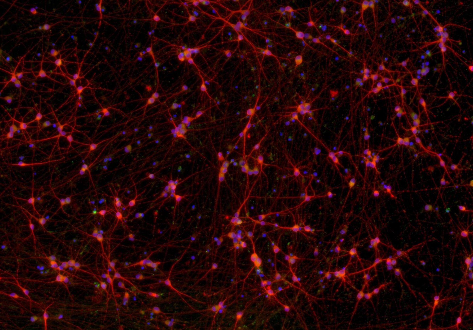 ioGlutamatergic-neurons-MAPT-N279K-hom-DAPI-MAP2-VGLUT2-overlay-1