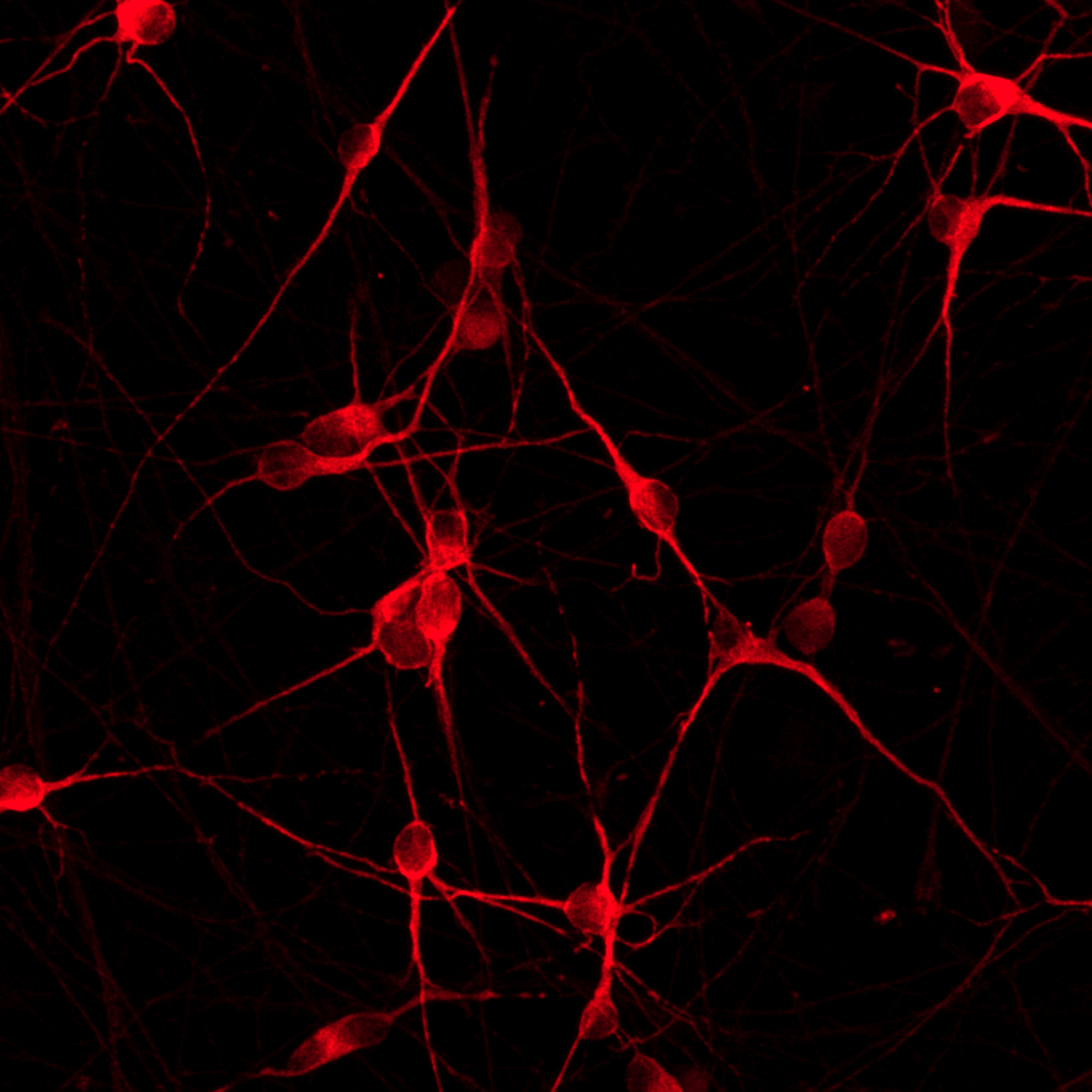 ioGlutamatergic Neurons MAPT N279K/WT
