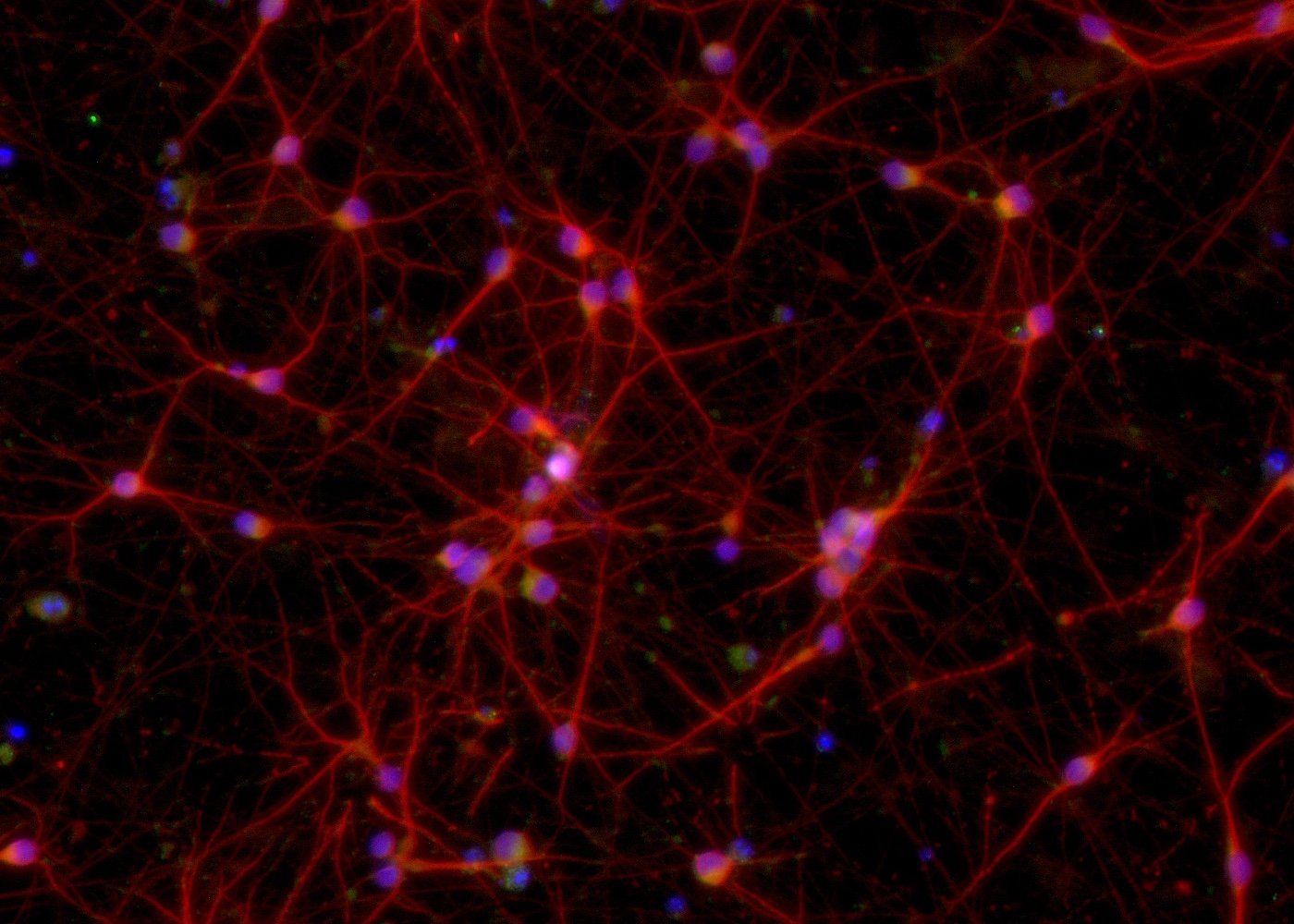 ioGlutamatergic Neurons MAPT P301S/P301S™
