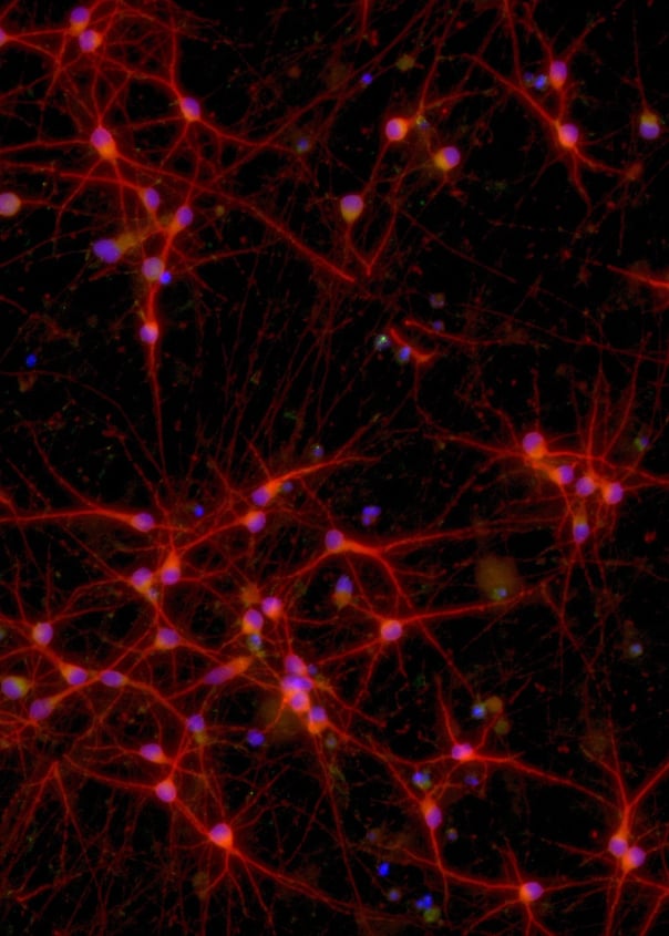 Development and characterisation of a robust in vitro disease model to study tauopathies