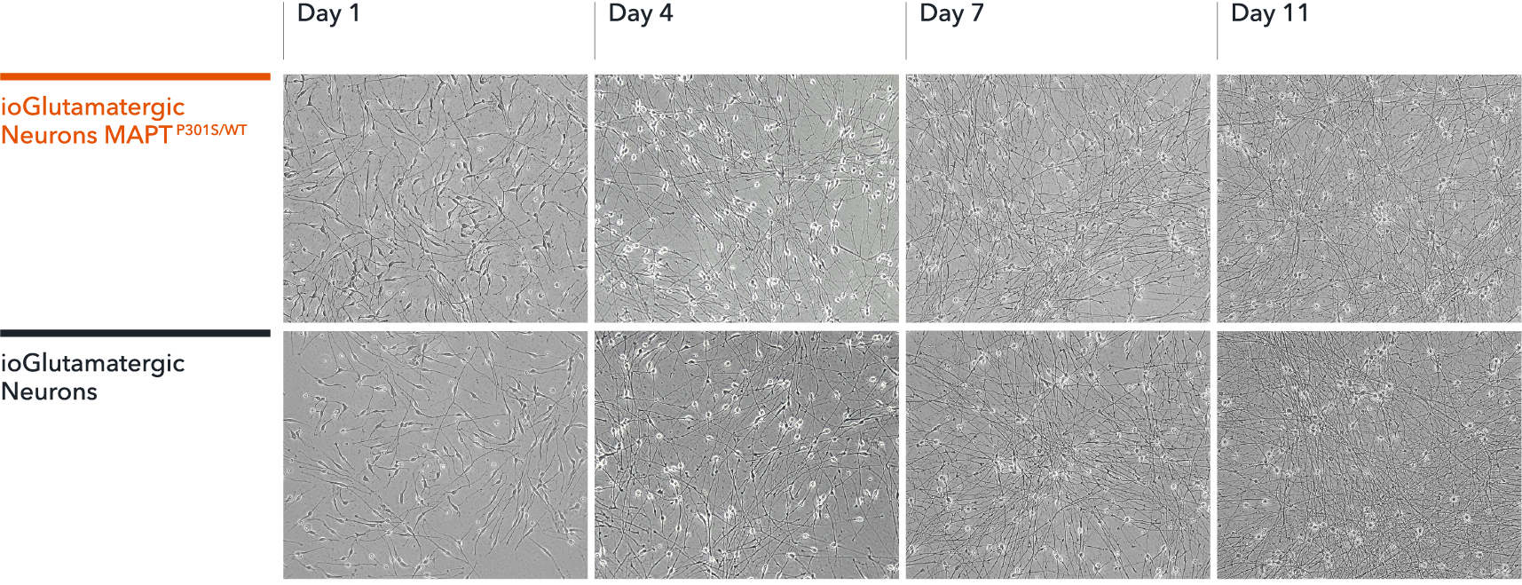 ioGlutamatergic neurons MAPT P301S/WT brightfield morphology