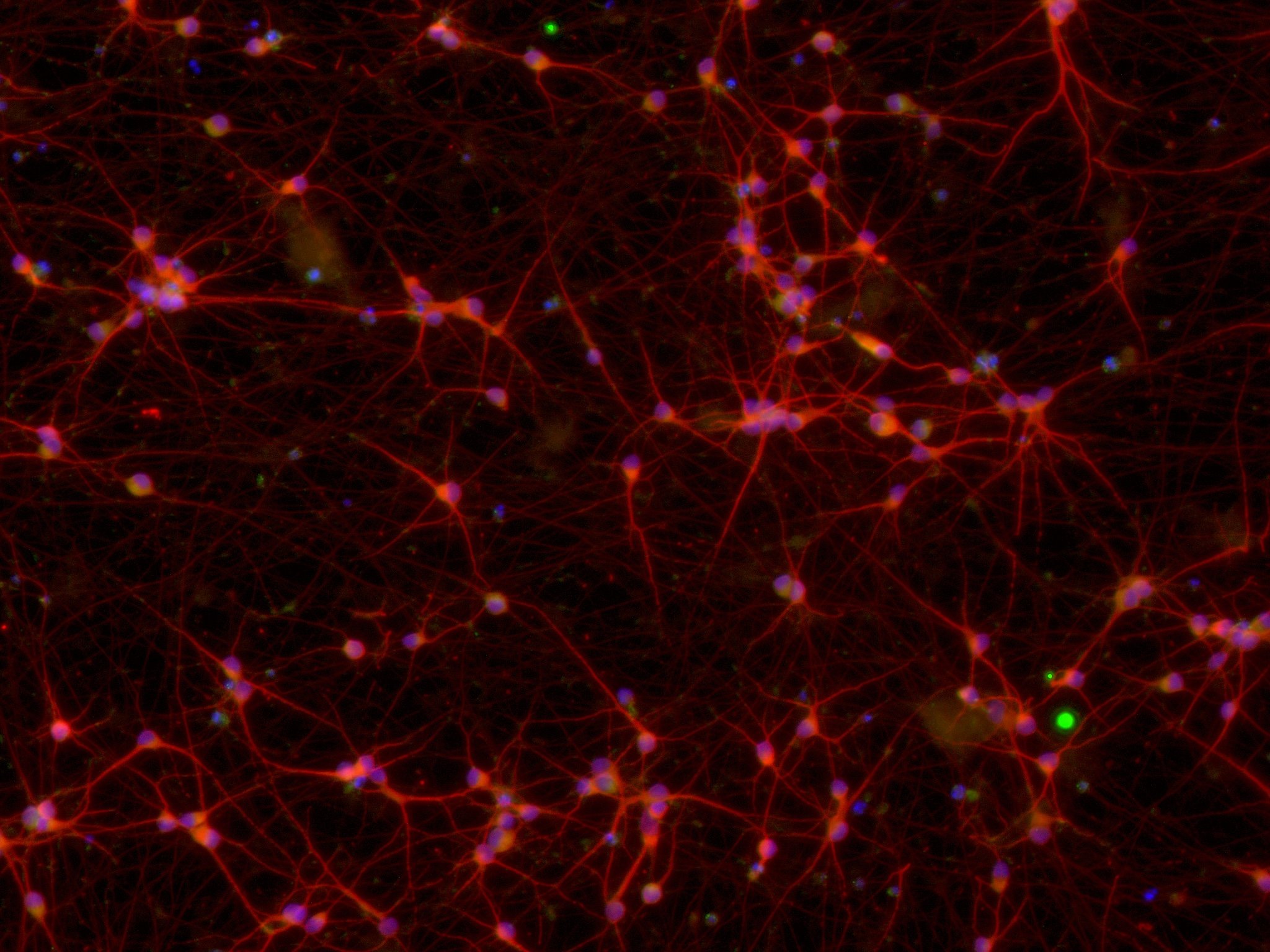 ioGlutamatergic Neurons MAPT P301S/WT