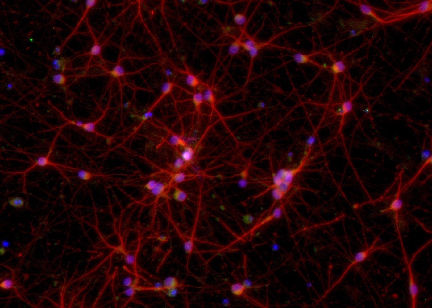 ioGlutamatergic Neurons MAPT P301S/P301S