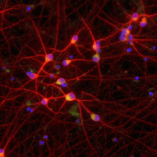 Validation of ALS-relevant phenotypes in precision reprogrammed iPSC-derived glutamatergic Neurons containing a TDP-43 M337V mutation.