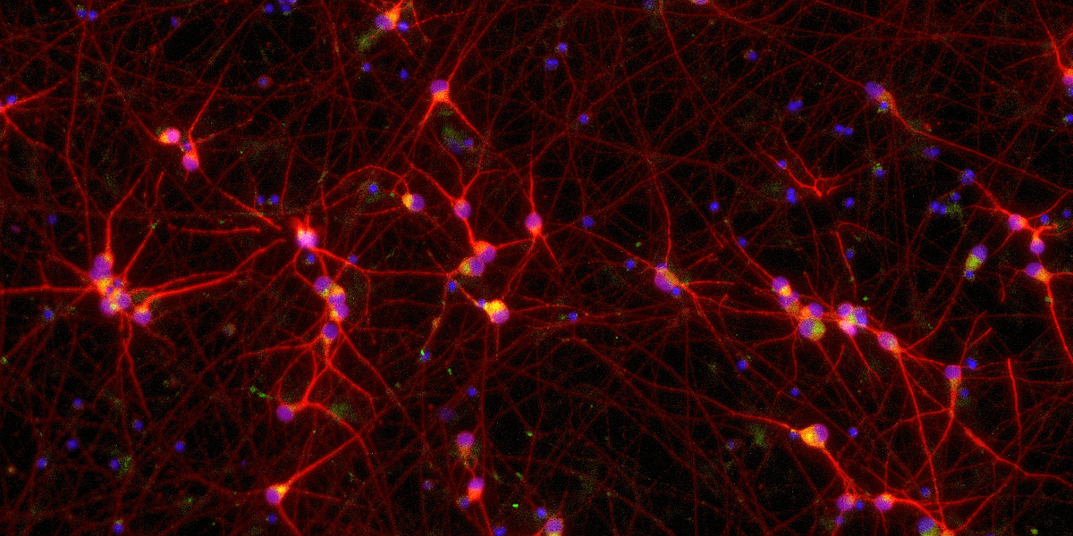 bit.bio ICC staining of iPSC-derived ALS/FTD glutamatergic neurons disease model