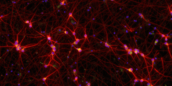Phenotypic characterisation of iPSC-derived ALS disease models by high-throughput MEA