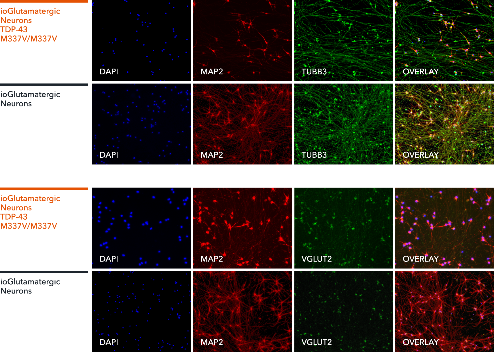 ioGlutamatergic_neurons-TDP43-M337V-M337V-ICC-VGLUT2