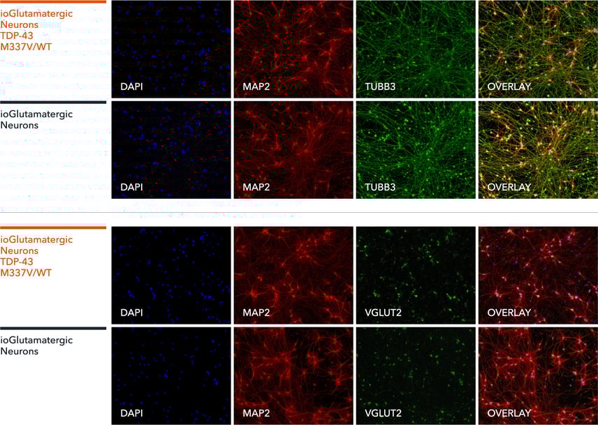 bit.bio Glutamatergic Neurons TDP-43 M337V het ICC staining of neuronal markers