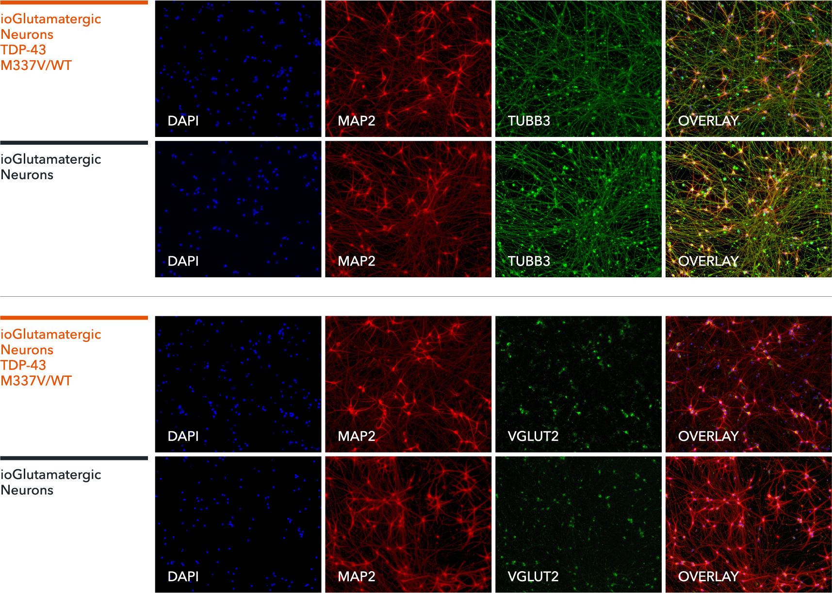 ioGlutamatergic_neurons-TDP43-M337V-WT-ICC-VGLUT2