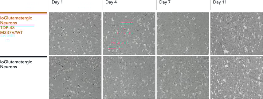 bit.bio Glutamatergic neuronal morphology of ALS/FTD disease model cells