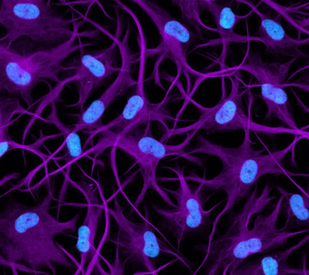 (UPDATED)ioAstrocytes_2.0_Hero_image_VIM_DAPI