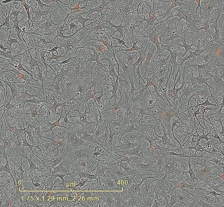 (UPDATED)ioAstrocytes_2.0_Phagocytosis_s.aureus_D7_thumbnail