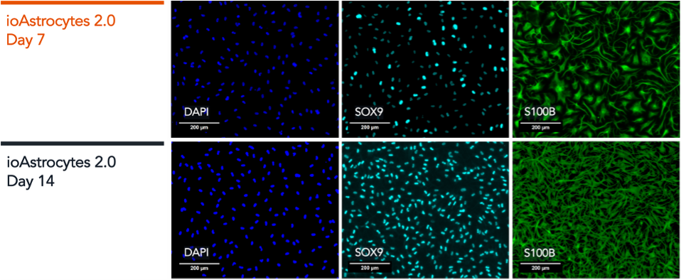 ioAstrocytes_2.0_ICC_Panel-1_DAPI_SOX9_S100B_D7_D14-1