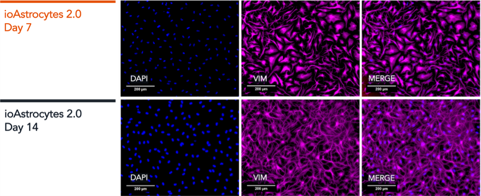 ioAstrocytes_2.0_ICC_Panel-2_DAPI_VIM_MERGE_D7_D14-1