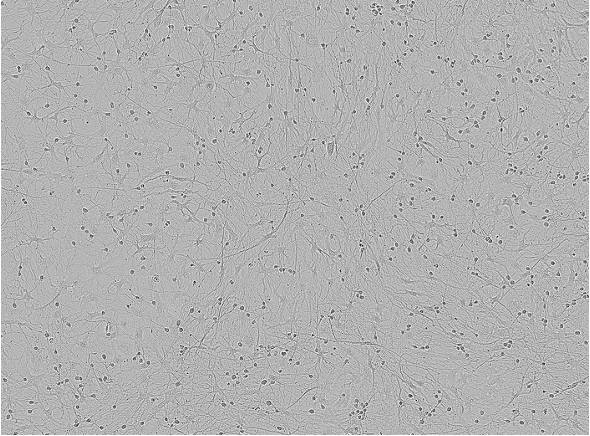 ioAstrocytes_ioGlutamatergic-Neurons_co-culture_DIV13