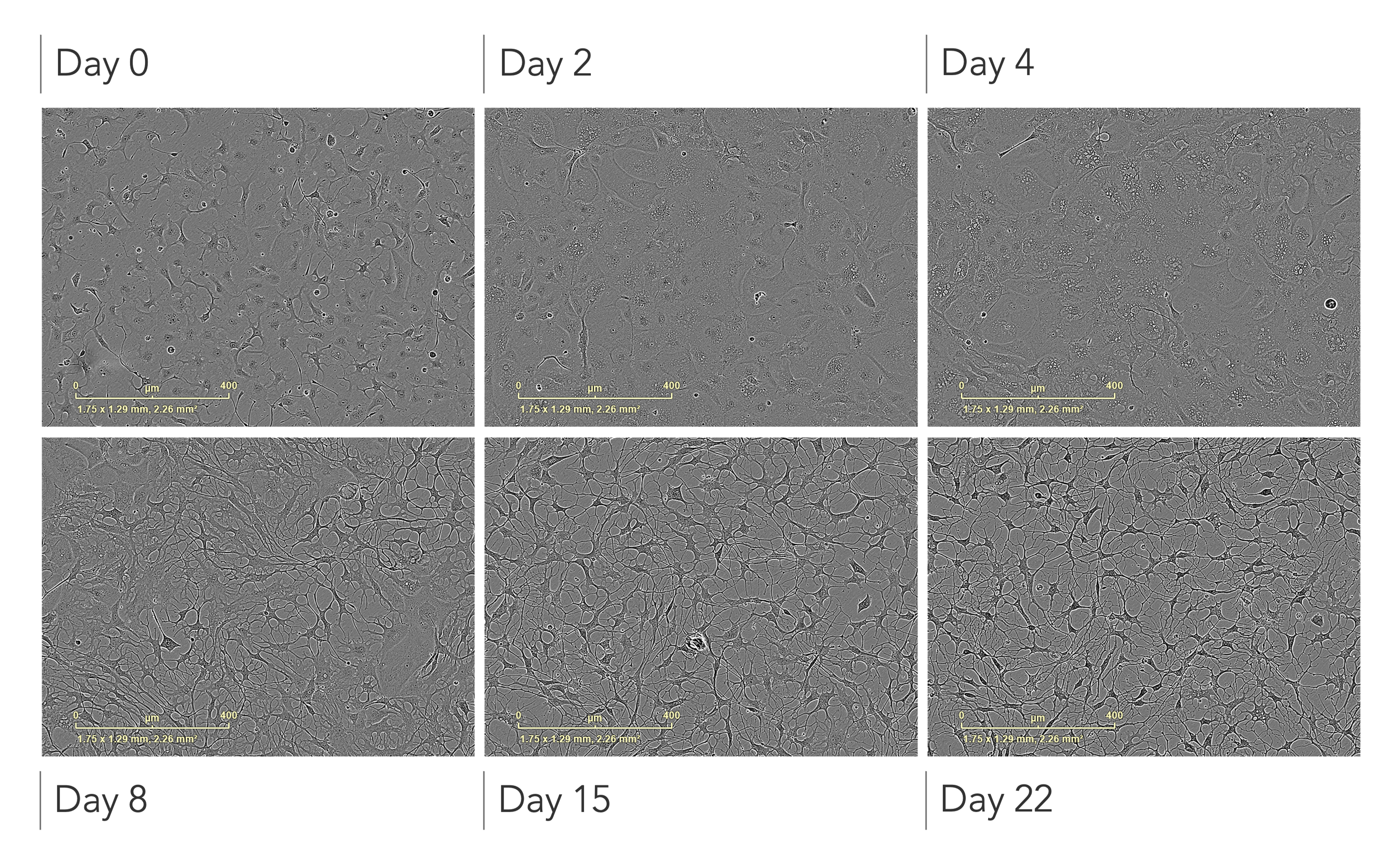 human_ipsc-derived_astrocytes_morphology_brightfield_images